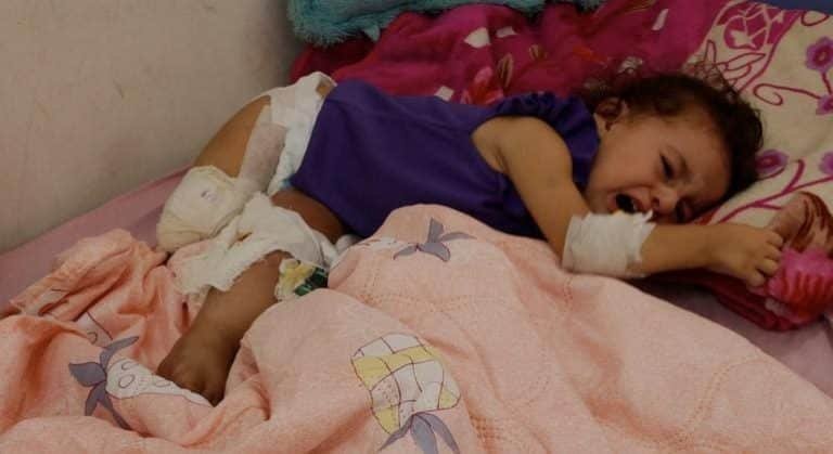 Poussé par la faim à Gaza, les amputés font partie des dommages collatéraux