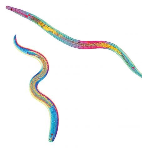 Les nématodes,  ici observés en micrographie par contraste interférentiel différentiel (DIC), constitueraient 80% des organismes pluricellulaires terrestres. Un seul mètre carré de sol peut en abriter plusieurs millions.