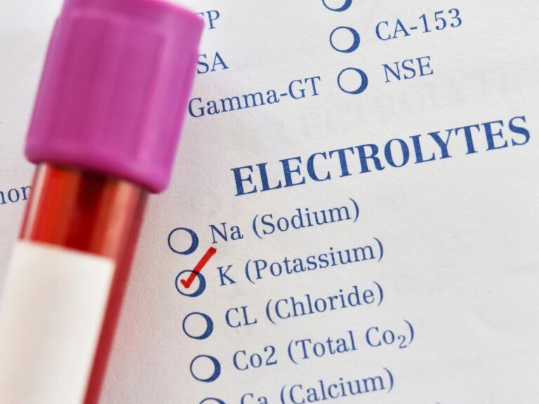 6 signaux d'alerte envoyés par votre corps quand vous manquez de potassium