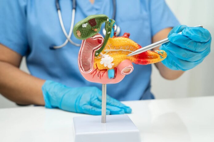 Calculs biliaires : peut-on vraiment les dissoudre sans passer par la chirurgie ? Calculs biliaires : peut-on vraiment les dissoudre sans passer par la chirurgie ?