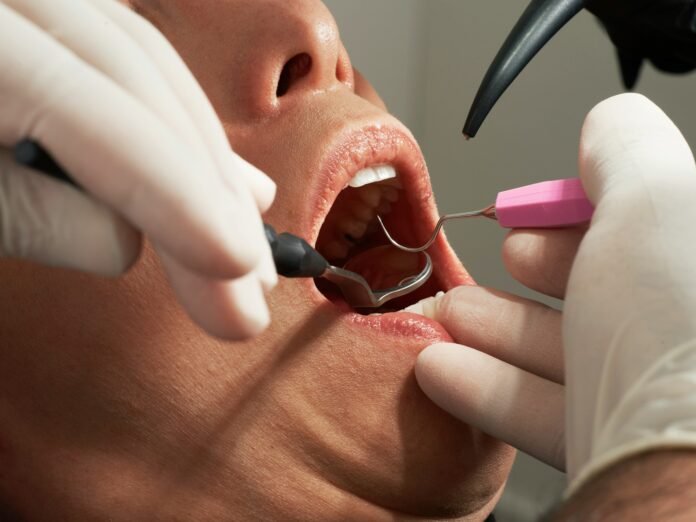 Implant dentaire : le guide patient pour un traitement bien encadré