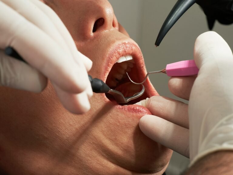 Implant dentaire : le guide patient pour un traitement bien encadré