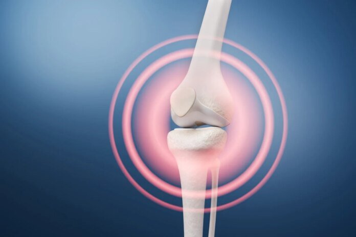 Arthrose : une simple injection pourrait la faire disparaître en quelques semaines