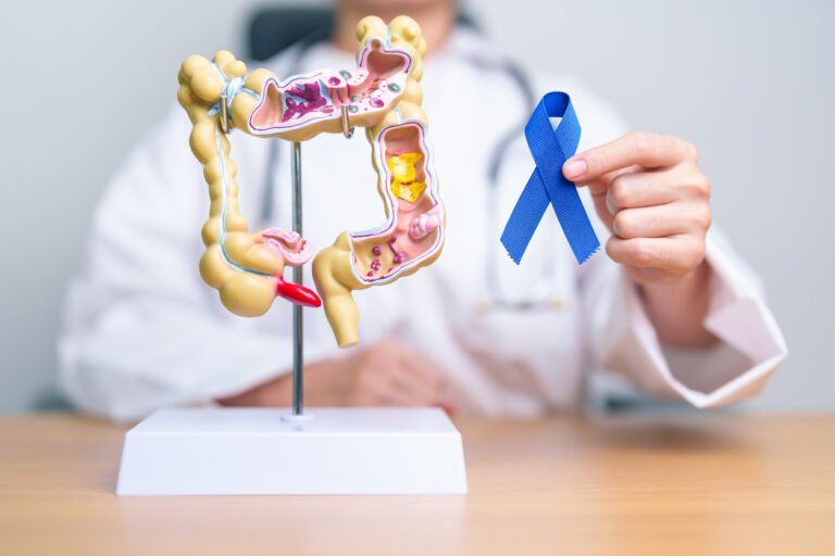 Cancer colorectal : un nouveau dépistage moins invasif