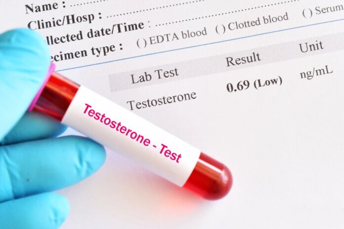 Le taux de testostérone a chuté de 50 % en 50 ans : quel impact sur la santé des hommes ?